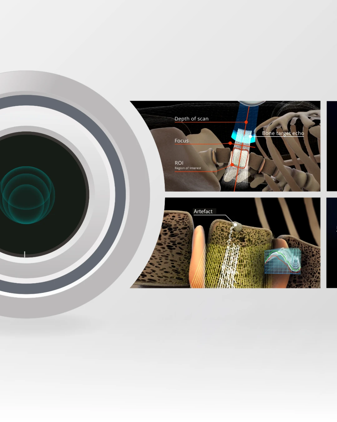 Osteoporosis Hero Background