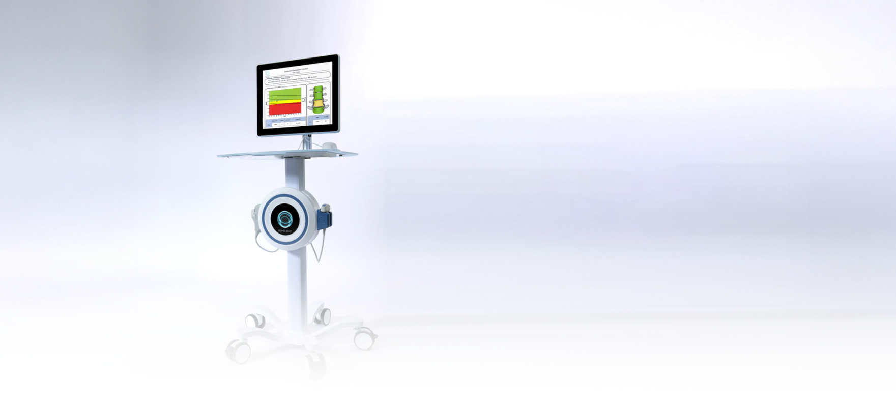 Configura tu producto